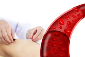 improve-blood-circulation-chiropractic-care-college-park