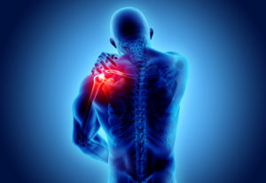 Improving Quality of Life with Chronic Shoulder Pain