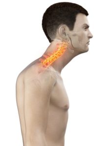 Fix Forward Head Posture